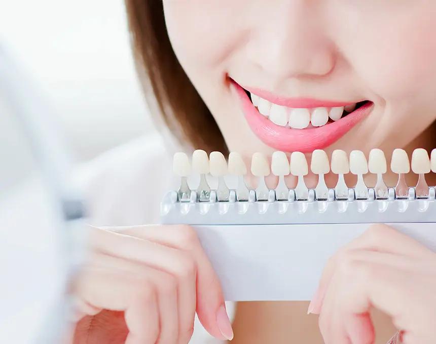 ホワイトニング